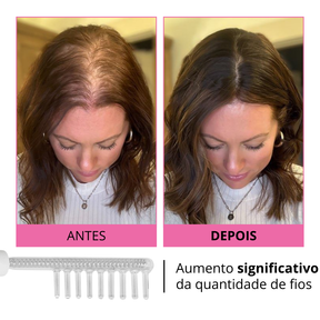 Kit AureaVitalis Alta Frequência | Tratamento Facial e Capilar