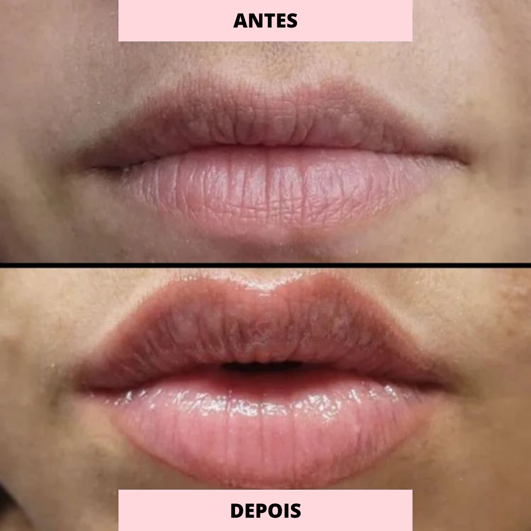 LIP_BOOSTER_CARROSSEL_20.png