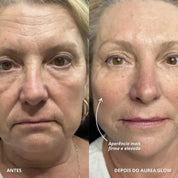 Aurea Glow | Dispositivo LED Com Tecnologia EMS Que Estimula Musculatura Facial