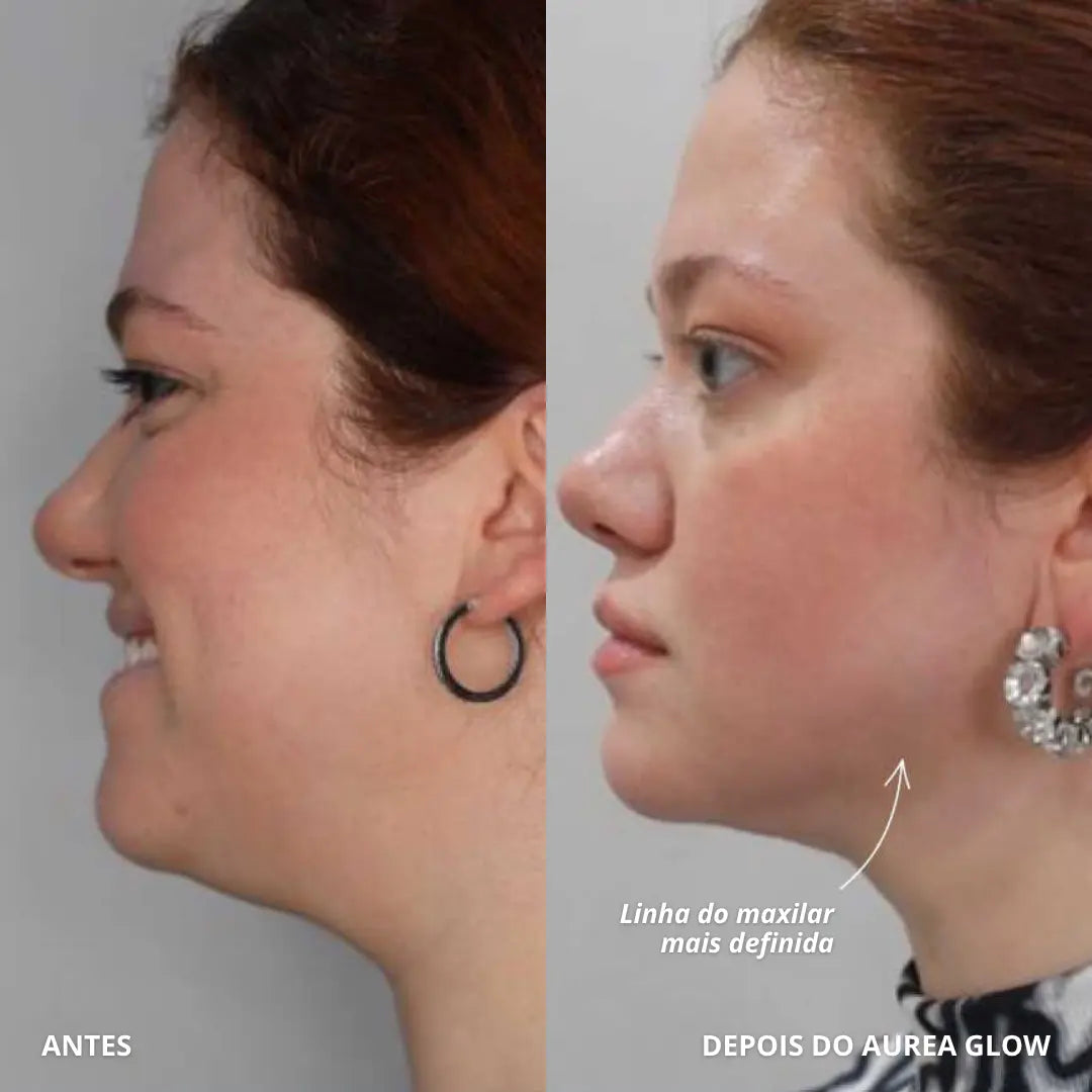 Aurea Glow | Dispositivo LED Com Tecnologia EMS Que Estimula Musculatura Facial