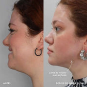 Aurea Glow | Dispositivo LED Com Tecnologia EMS Que Estimula Musculatura Facial