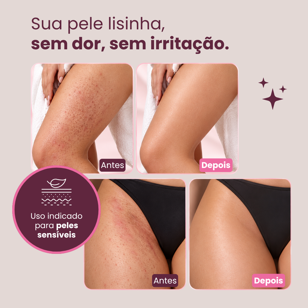 Depilador LisseCare™ 4 em 1 - Recarregável e À Prova D'Água