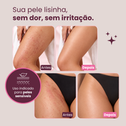 Depilador LisseCare™ 4 em 1 - Recarregável e À Prova D'Água