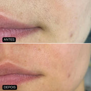 Caneta Depiladora MicroTouch™ | Depilação Perfeita e Precisa